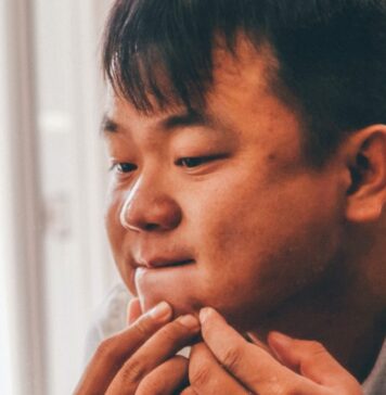 Topical Green Tea for Acne and Fungal Infections | Nutrition Fit