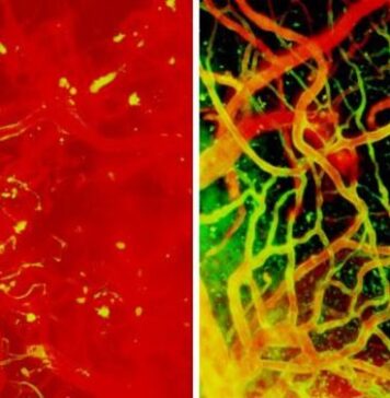 Timing Is of the Essence When Treating Brain Swelling in Mice | Nutrition Fit