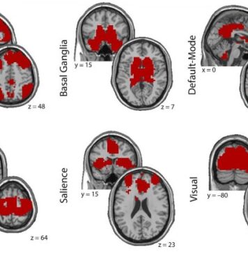 Secrets of Traumatic Stress Hidden in the Brain Are Exposed | Nutrition Fit