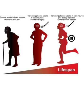 Better Diet and Glucose Uptake in the Brain Lead to Longer Life | Nutrition Fit