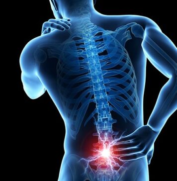 No Evidence That SNRIs Relieve Back Pain | Nutrition Fit