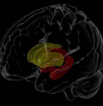 Study Measures Brain Volume Differences in People With HIV | Nutrition Fit