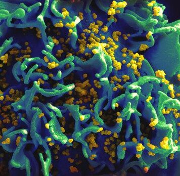 Good News Now, and Maybe Later, for HIV Patients | Nutrition Fit