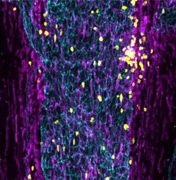 How Does the Immune System Keep Tabs on the Brain? | Nutrition Fit