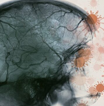 COVID-19 May Damage Blood Vessels in the Brain | Nutrition Fit