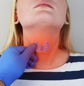 Global Thyroid Cancer Overdiagnosis in Children and Adolescents | Nutrition Fit