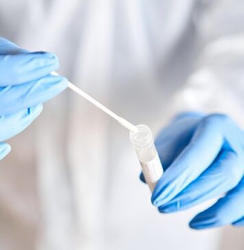 South Has High Rate of Unreported COVID Deaths, Study Says | Nutrition Fit