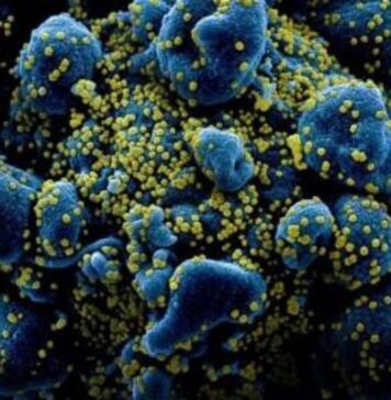 Melatonin Produced in the Lungs Prevents Infection by COVID-19 | Nutrition Fit