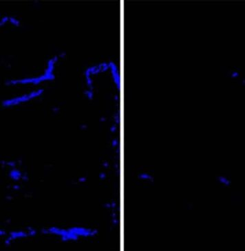 Protein Linked to Alzheimer’s and Strokes Cleared From Brain Blood Vessels | Nutrition Fit