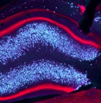 Deep Brain Stimulation Prevents Epileptic Seizures | Nutrition Fit