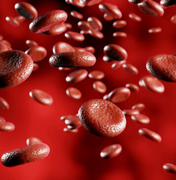 In-hospital Hemoglobin Drop Tied to 1-Year Mortality After ACS | Nutrition Fit