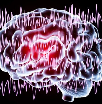 EEG Data May Help Aid Diagnosis, Treatment of Focal Epilepsy | Nutrition Fit