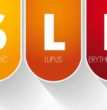 Meta-Analysis Finds Much Less Lupus Than Expected | Nutrition Fit