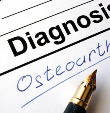 Rheumatologic Disease Activity Influences COVID-19 Death Risk | Nutrition Fit