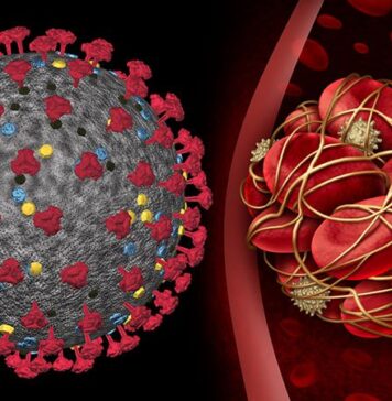 More Evidence Supports Early Anticoagulation in COVID-19 | Nutrition Fit