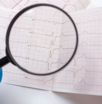 AI Crushes Expert Reader at ECG Recognition of Long-QT Syndrome | Nutrition Fit