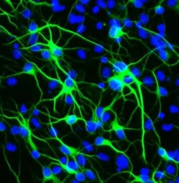How a Longevity Gene Protects Brain Stem Cells From Stress | Nutrition Fit