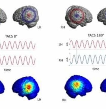 Changing the Connection Between the Hemispheres Affects Speech Perception | Nutrition Fit