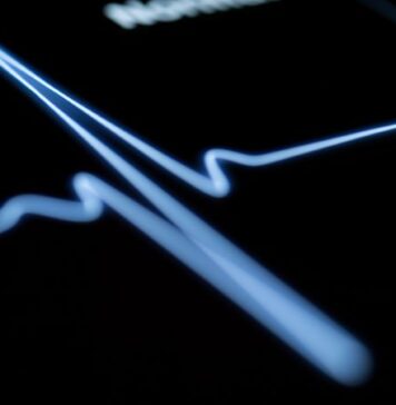 Cardiac Activity Not Uncommon After Lifesaving Measures Stop | Nutrition Fit