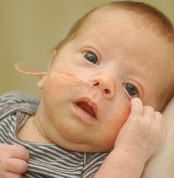 ‘Feed Early, Feed Well’ With Enteral Nutrition | Nutrition Fit