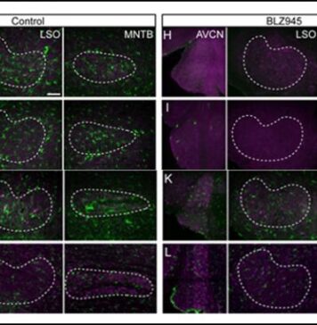Auditory Brainstem Pathways Do Not Develop Properly Without Microglia | Nutrition Fit