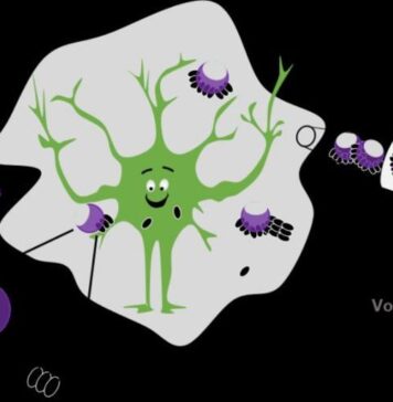 Nanoparticles Help Untangle Alzheimer’s Disease Amyloid Beta Plaques | Nutrition Fit