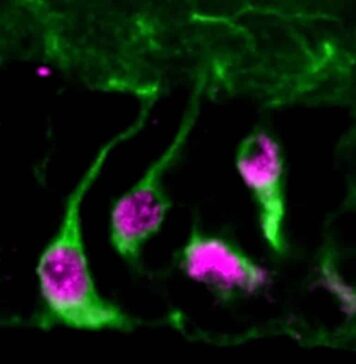Wake-up Call for Neural Stem Cells | Nutrition Fit