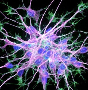 Weill Neurohub Joins With Genentech and Roche to Advance Neuroscience Research | Nutrition Fit