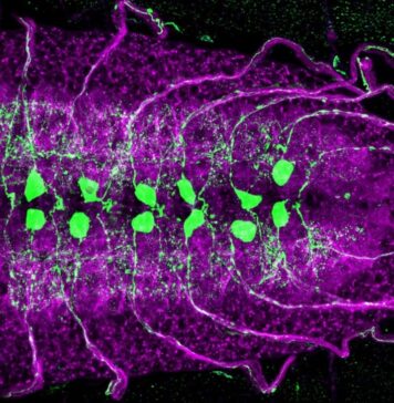 How Some Neurons Compensate for Death of Their Neighbors | Nutrition Fit