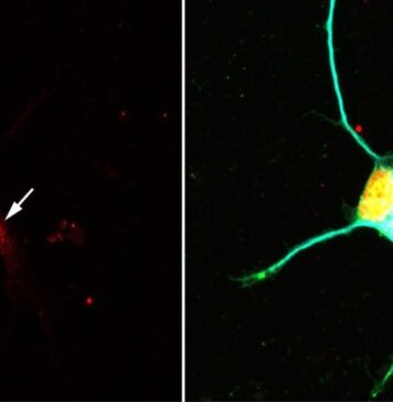 New Signaling Pathway in Neurons | Nutrition Fit