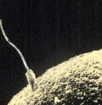 Compound Isolated From Human Sperm Could Treat Genetic Disorder | Nutrition Fit