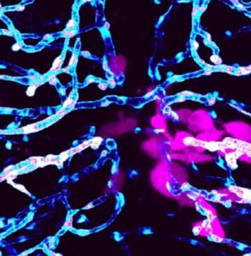 Parallels in Spread of Brain Cancer in Mammals and Zebrafish | Nutrition Fit