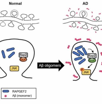 Uncovering the Molecular Mechanism Behind Synapse Loss in Alzheimer’s Disease | Nutrition Fit