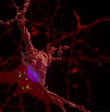 New Discovery for How the Brain ‘Tangles’ in Alzheimer’s Disease | Nutrition Fit