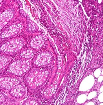 A New Standard of Care? | Nutrition Fit