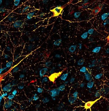 Animal Model Opens Way to Test Alzheimer’s Disease Therapies | Nutrition Fit