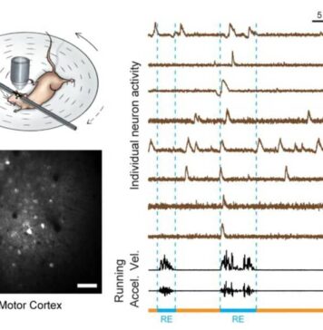 Researchers Close in on Root of Slow Motor Learning in Autism | Nutrition Fit