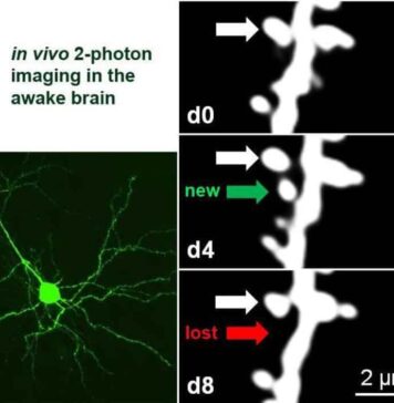 Watching the Brain Learn – Neuroscience News | Nutrition Fit
