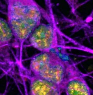DNA Damage ‘Hot Spots’ Discovered Within Neurons | Nutrition Fit