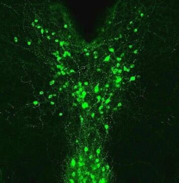 Parsing Dopamine’s Different Pain Sensitivity Role in Males and Females | Nutrition Fit