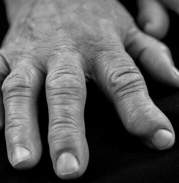 RA Experts Highlight Key Developments Over the Past Year | Nutrition Fit