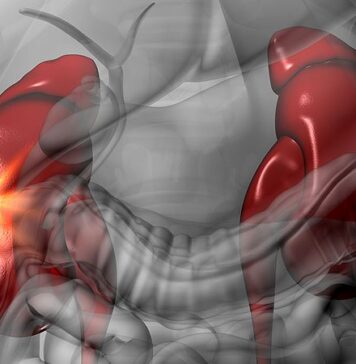 Infections — Especially Urinary and Kidney — Are Higher in MS | Nutrition Fit