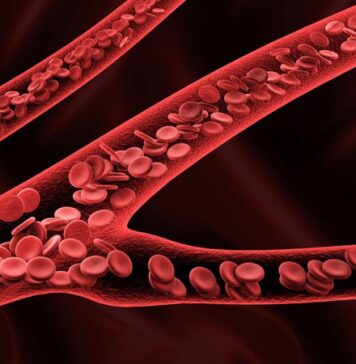 Docs Debate Blood Thinners to Prevent Clots After C-Section | Nutrition Fit