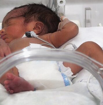 Preterm Infant Supine Sleep Positioning Becoming More Common | Nutrition Fit