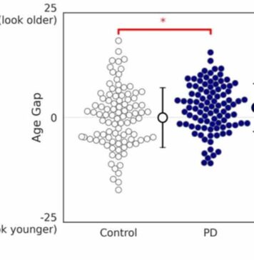 Using Facial Analysis Algorithm to Track Changes Due to Parkinson’s Disease | Nutrition Fit