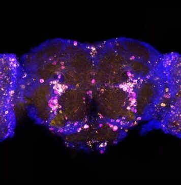 Genetic Treatment Extends Fruit Fly Lifespan and Prevents Alzheimer’s Damage | Nutrition Fit
