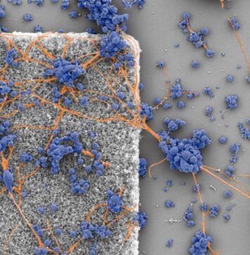Unveiling the Weaving Fractal Network of Connecting Neurons | Nutrition Fit