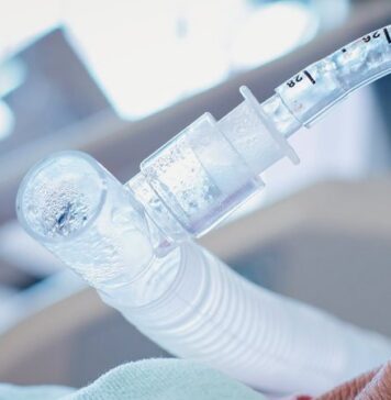 Postintubation Tracheal Injury in the COVID-19 Era | Nutrition Fit