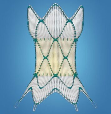 FDA OKs Transcatheter Pulmonary Valve for Congenital Heart Disease | Nutrition Fit