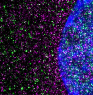 Huntington’s Disease Driven by Slowed Protein-Building Machinery in Cells | Nutrition Fit